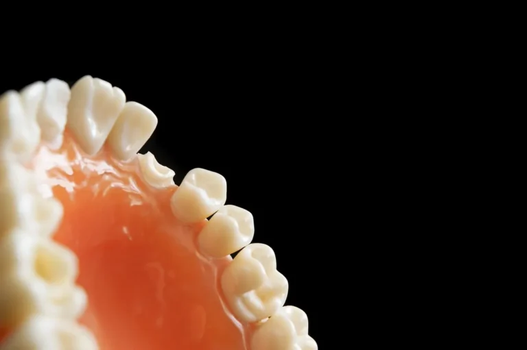 Rêver de perdre ses dents : Peur, changement ou vitalité ?