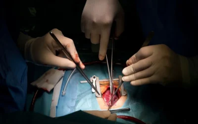 A group of people doing surgery in a dark room