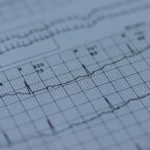 A close up of a medical paper with a graph on it