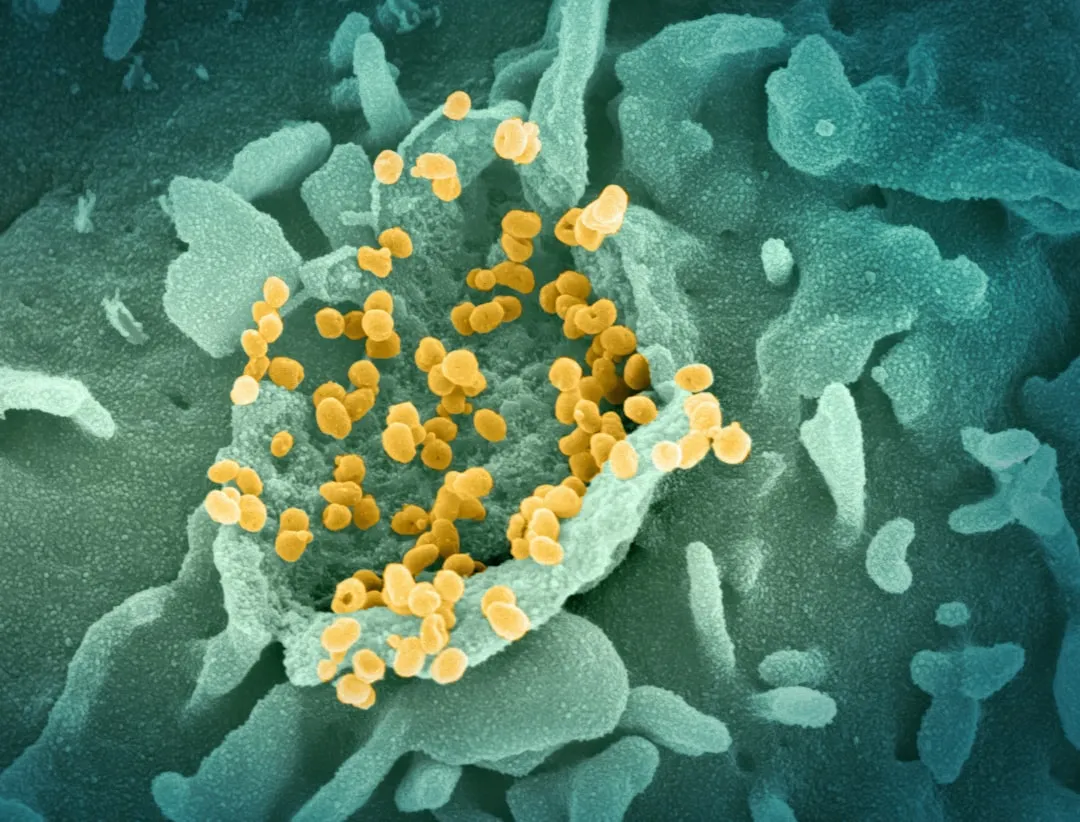 a close up of a cell with yellow dots