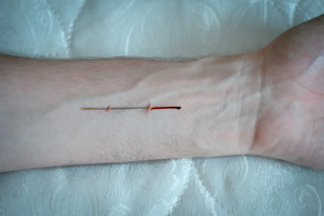 A fresh cut on a person's wrist is visible.
