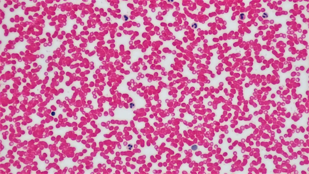 Microscopic view of red blood cells and leukocytes.