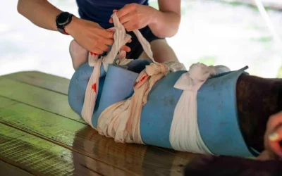 Applying a splint to an injured leg with bandages.